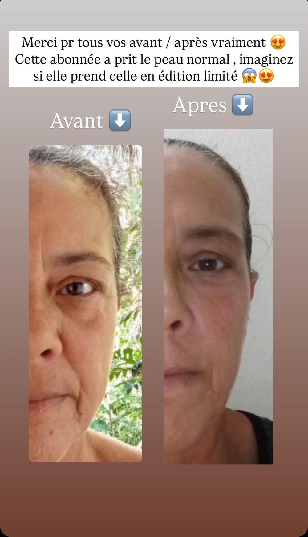 Le côté du visage, avant à gauche et après à droite